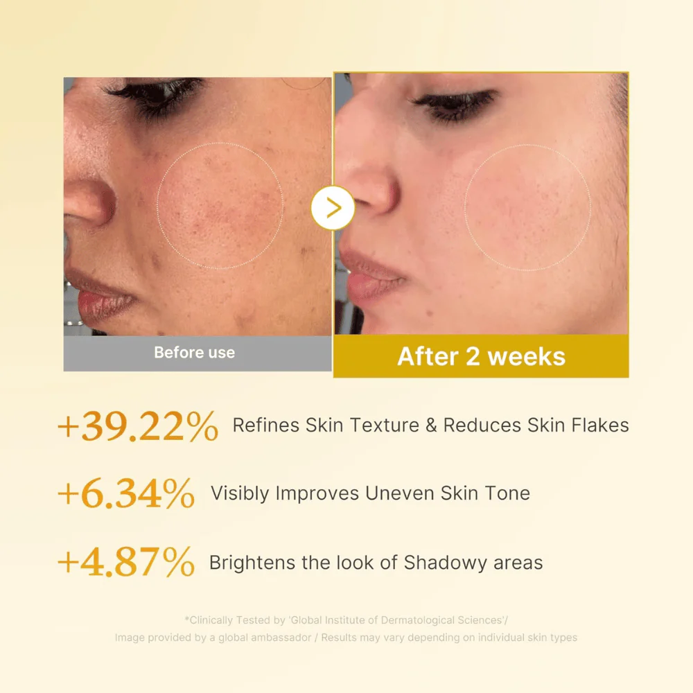 Kojic Acid Turmeric Resurfacing Toner 250ml - Image 4